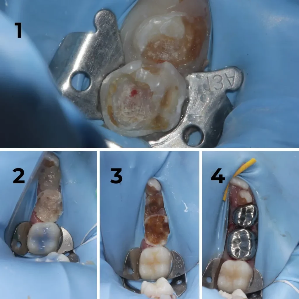 Tongue Tie Treatment in Shivaji Nagar