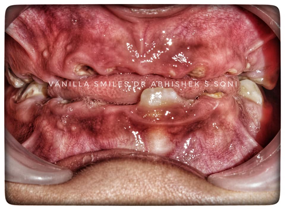 Orthodontic Treatment in Fc Road