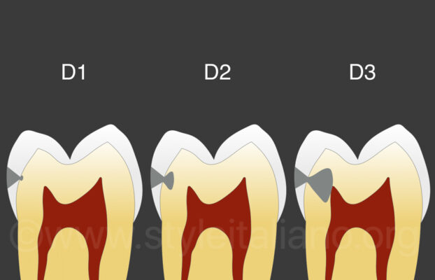 Management of Dental Caries, Behavior management: “the Tell-show-do technique”