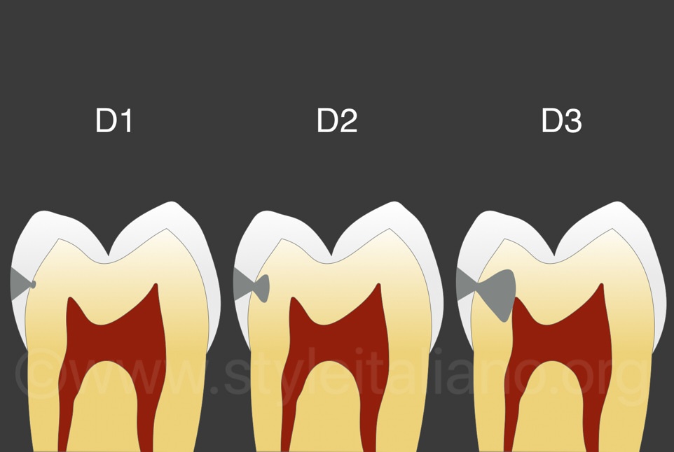 Management of Dental Caries, Behavior management: “the Tell-show-do technique”