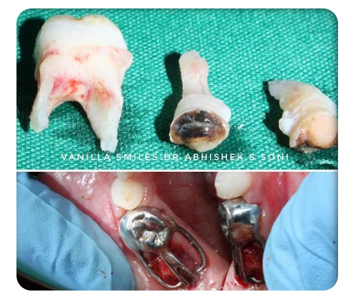 Orthodontic Treatment in Fc Road