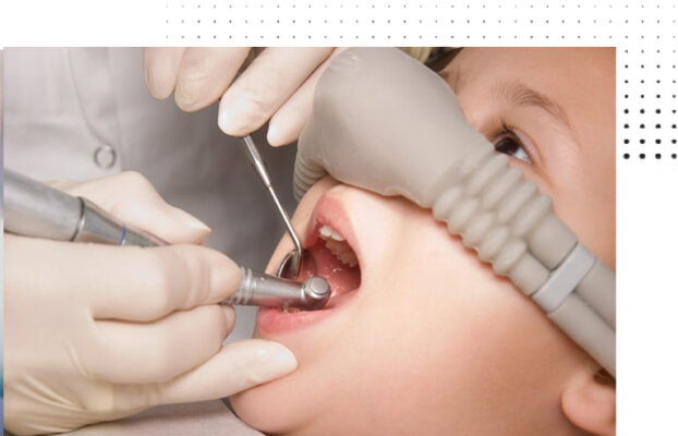 Does Laughing Gas Works For All?- Kid’s Dental Treatment