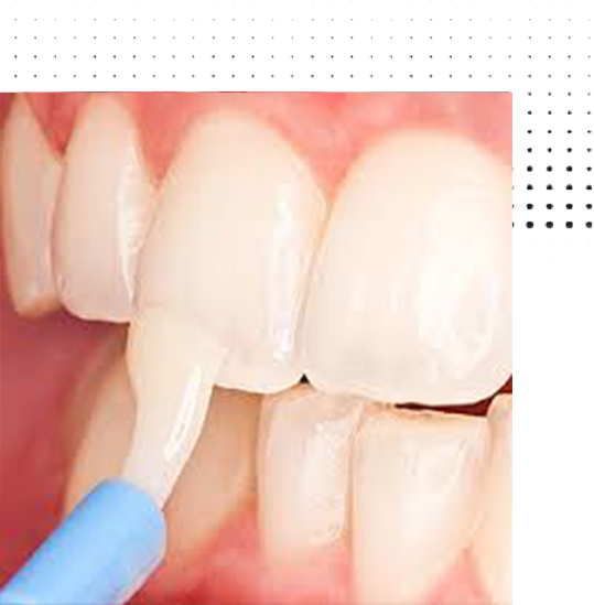 dental clinic in Shivaji nagar