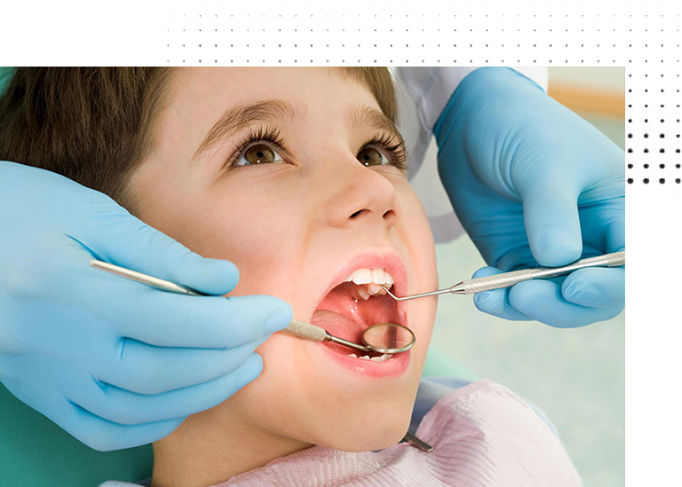 Root canal Treatment in Deccan