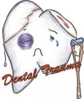 Wisdom Tooth removal in Shivaji Nagar