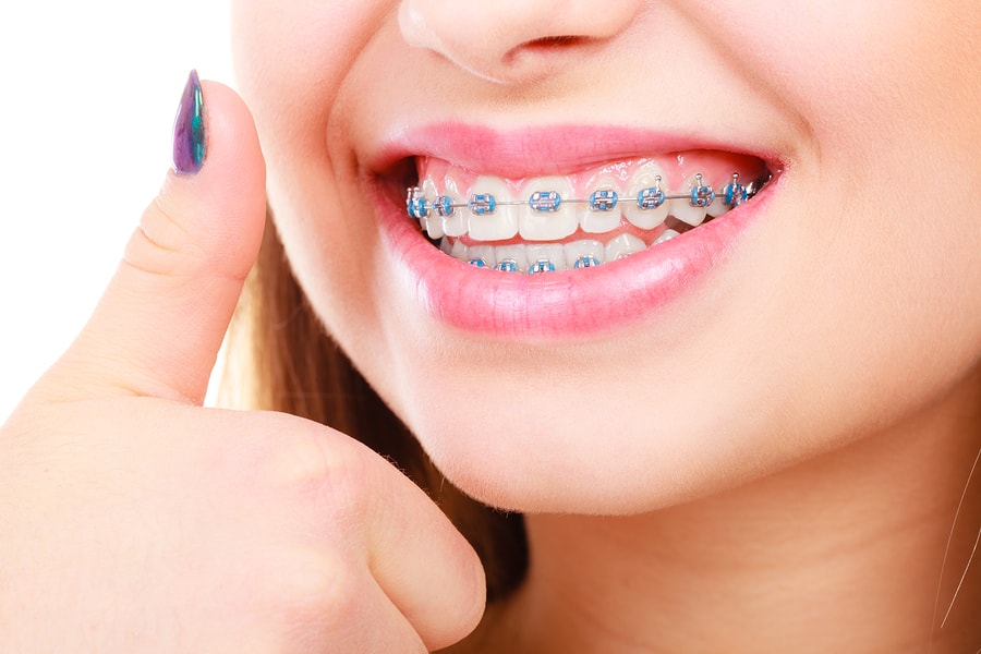 Orthodontics in Pune: It’s Never Too Late for a Perfect Smile