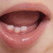 Milk Teeth of child