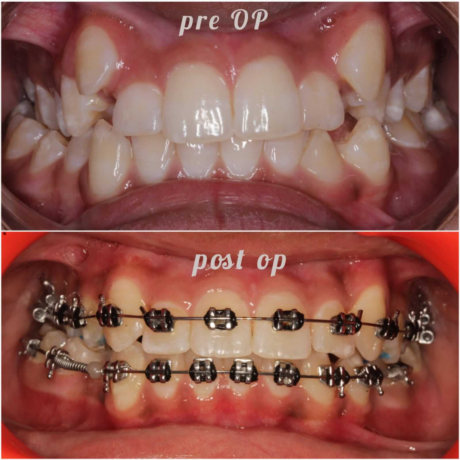 Unleash Your Radiant Smile: Pune’s Top Orthodontists for a Life-Changing Transformation