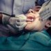 Tooth Extraction in Shivaji Nagar