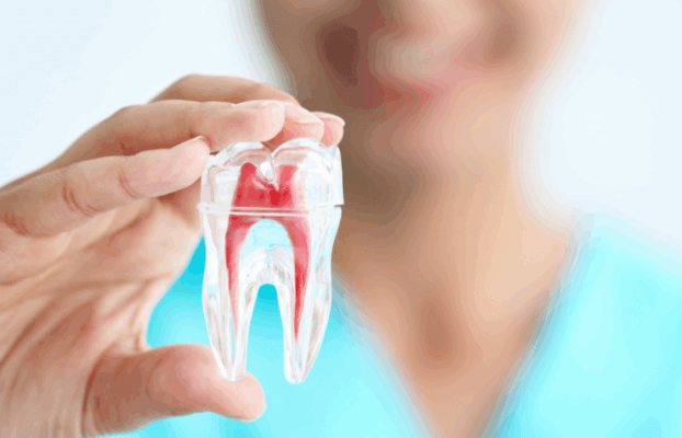 Signs You Might Need Root Canal Treatment – Expert Insights from Vanilla Smiles Dental Clinic, Pune