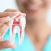 Root Canal Treatment Pune
