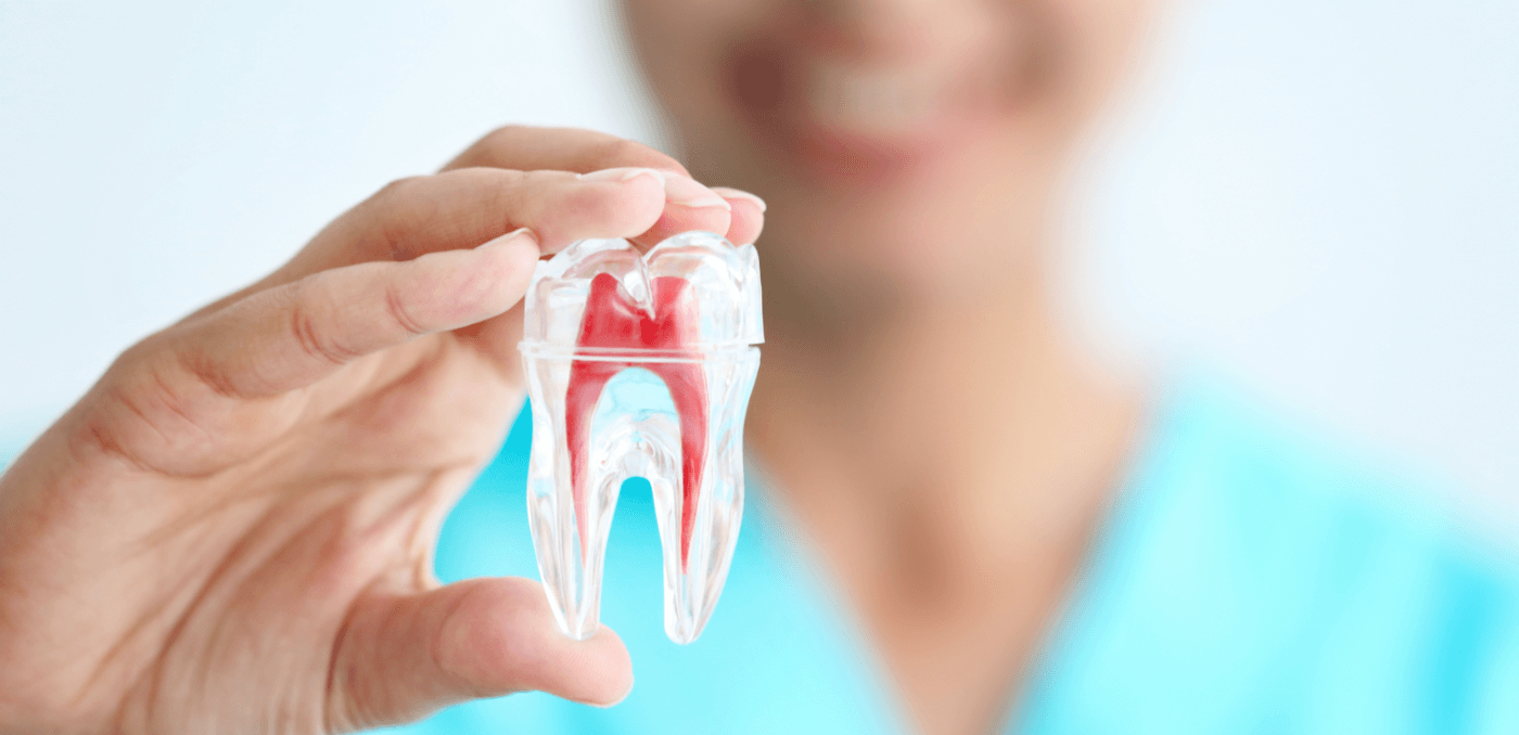 Signs You Might Need Root Canal Treatment – Expert Insights from Vanilla Smiles Dental Clinic, Pune