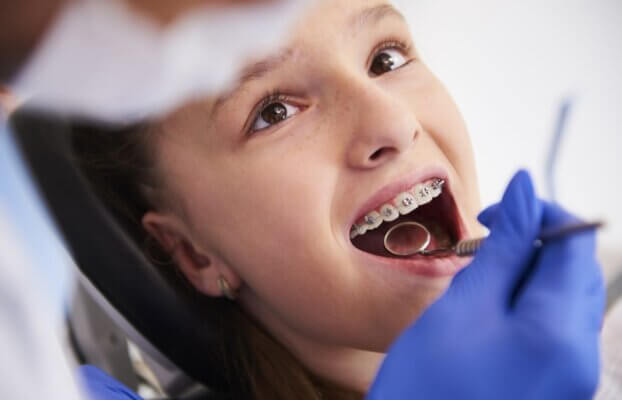 Choosing the Right Smile: Types of Dental Braces for Kids at Vanilla Smiles Dental Clinic, Shivaji Nagar, Pune