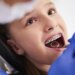 Dental Braces for Kids