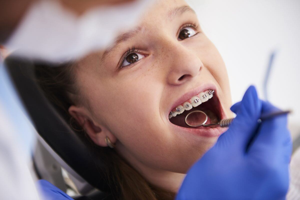 Choosing the Right Smile: Types of Dental Braces for Kids at Vanilla Smiles Dental Clinic, Shivaji Nagar, Pune