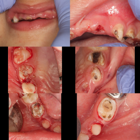 Does Dental Treatment Cost More Or Negligence ?