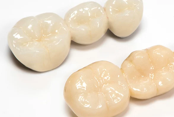 Zirconia Crowns