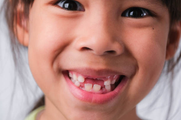 Stages of Tooth Eruption in Children: Expert Guide by Pediatric Dentist in Pune