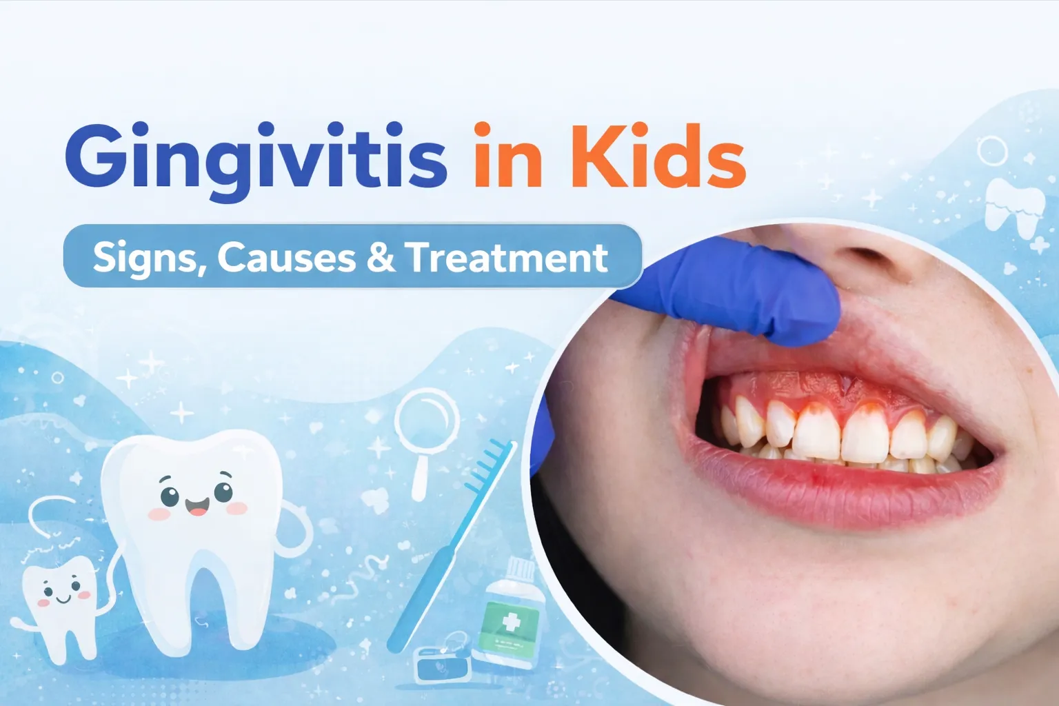 What Causes Gingivitis in Kids? Common Reasons Parents Should Know