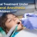 General Anesthesia