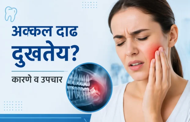 अक्कल दाढ (Wisdom Tooth) दुखतेय? कारणे, लक्षणे आणि योग्य उपचार मार्गदर्शक