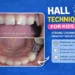 hall technique