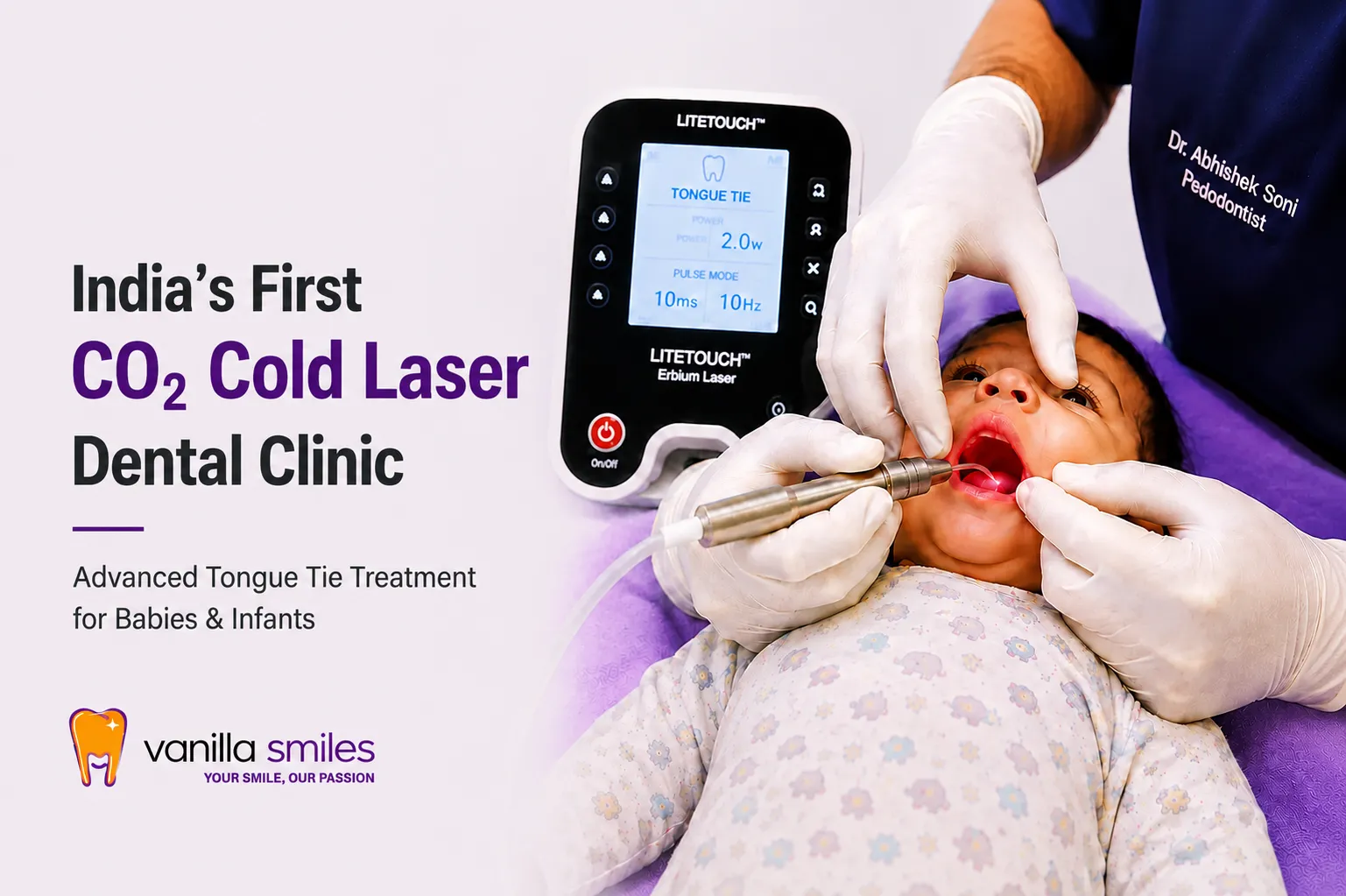 First CO₂ Cold Laser Dental Clinic in India: What Makes It Unique?