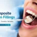 Composite Resin Fillings