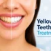Yellow Teeth Treatment