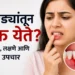 Bleeding Gums