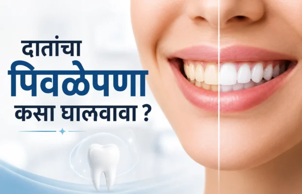 दातांचा पिवळेपणा (Yellow Teeth) कसा घालवावा ? – प्रभावी उपाय, आधुनिक उपचार आणि सुंदर हास्यासाठी मार्गदर्शन