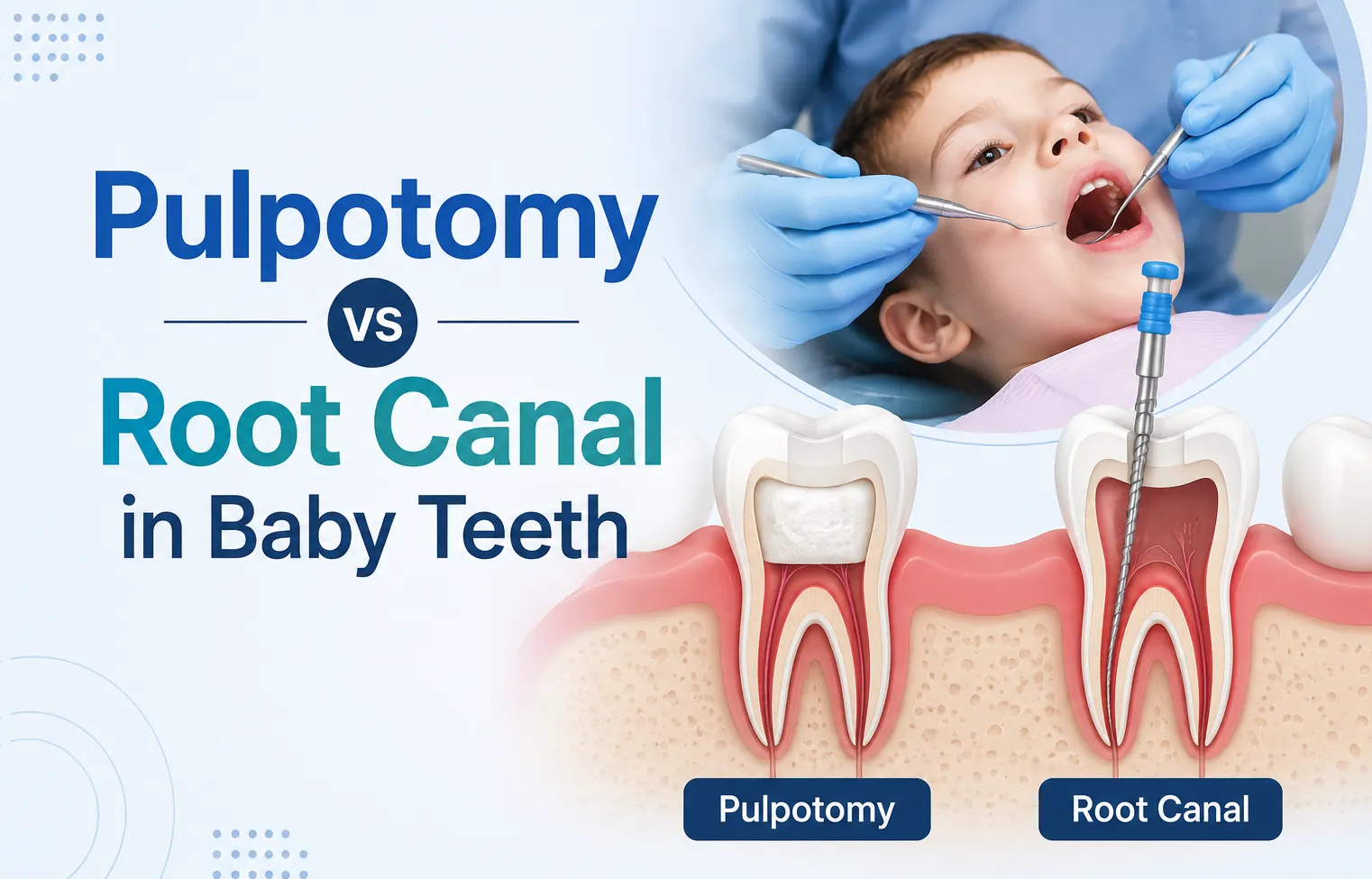 Pulpotomy vs Root Canal in Baby Teeth: What’s the Difference and Which Treatment Does Your Child Need?