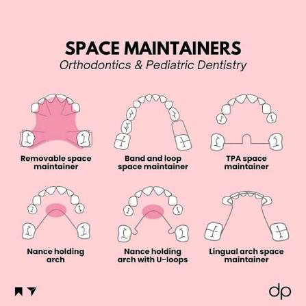 Fixed Space Maintainers