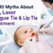CO₂ Laser Tongue Tie & Lip Tie Treatment