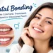 Dental Bonding