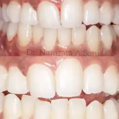 smile designing smile designing