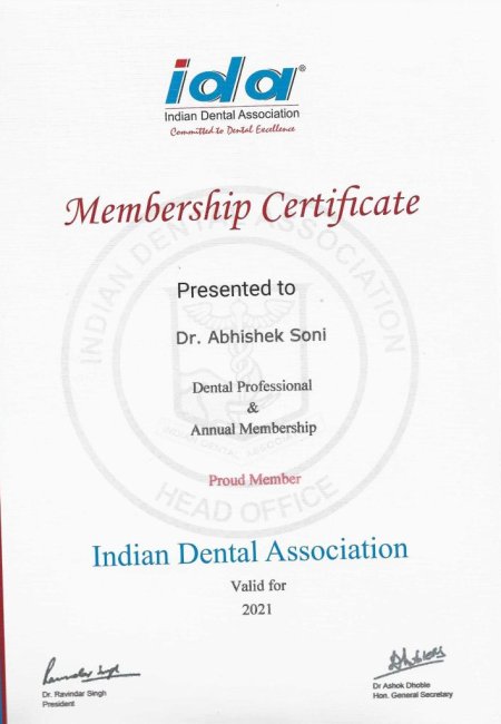 Dental Crowns in Fc road